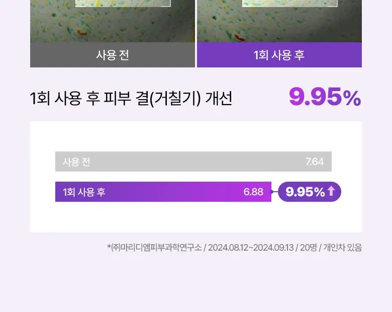 [고보습미스트] 바이오힐보 프로바이오덤 3D 리프팅 크림 에센스 100mL 상세페이지 33